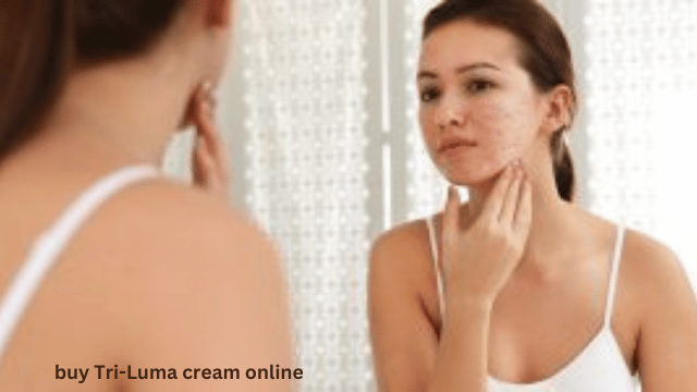 buy Tri-Luma cream online